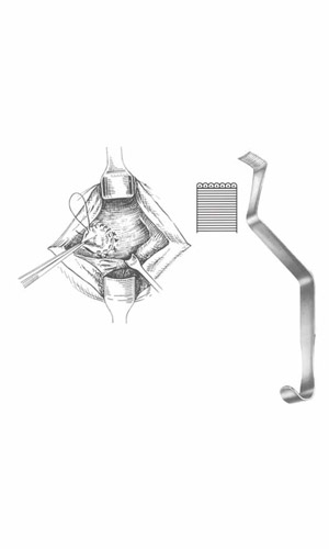 Aorta Retractors